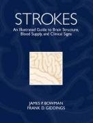 Strokes: An Illustrated Guide to Brain Structure, Blood Supply and Clinical Sig
