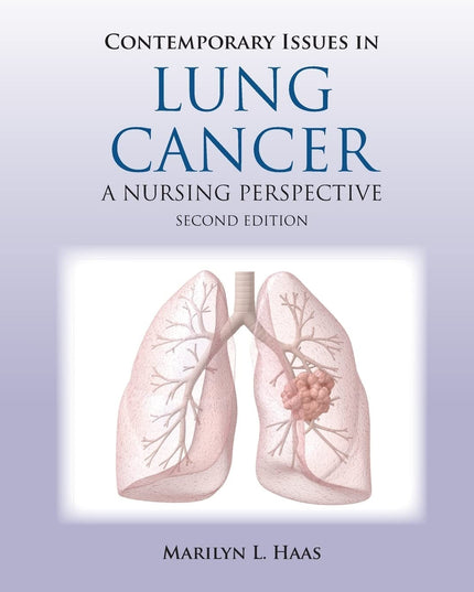 Contemporary Issues in Lung Cancer: .