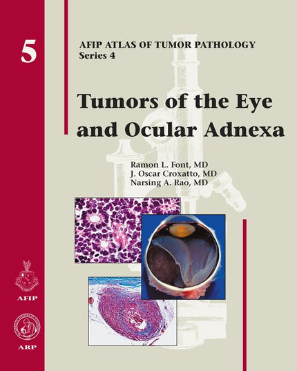 Tumors of the Eye and Ocular Adnexa (Afip Atlas of Tumor Pathology)