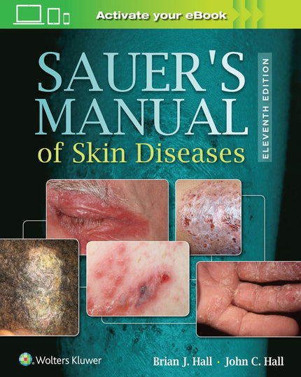 Sauer's Manual of Skin Diseases