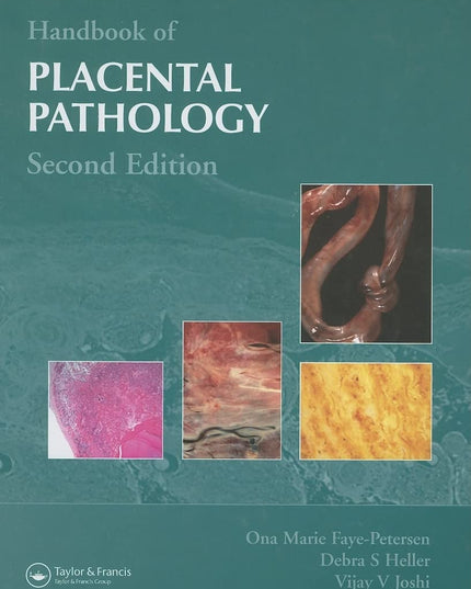 Handbook of Placental Pathology